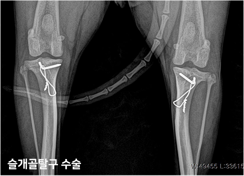 슬개골탈구 수술