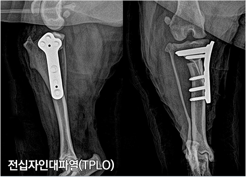 전십자인대파열-TPLO